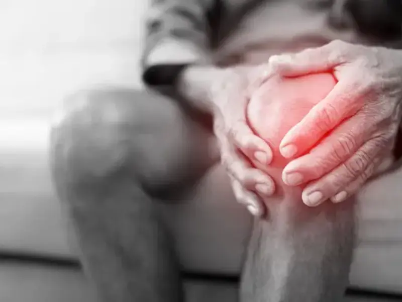 Knee osteoarthritis - clinical fact sheet and MCQ