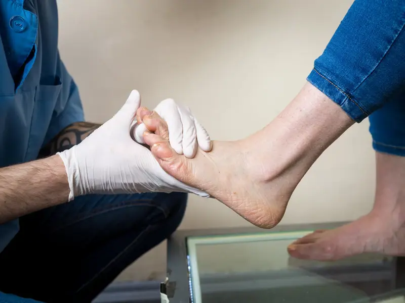 Peripheral Arterial Disease: Assessment Techniques