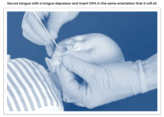OPA Insertion