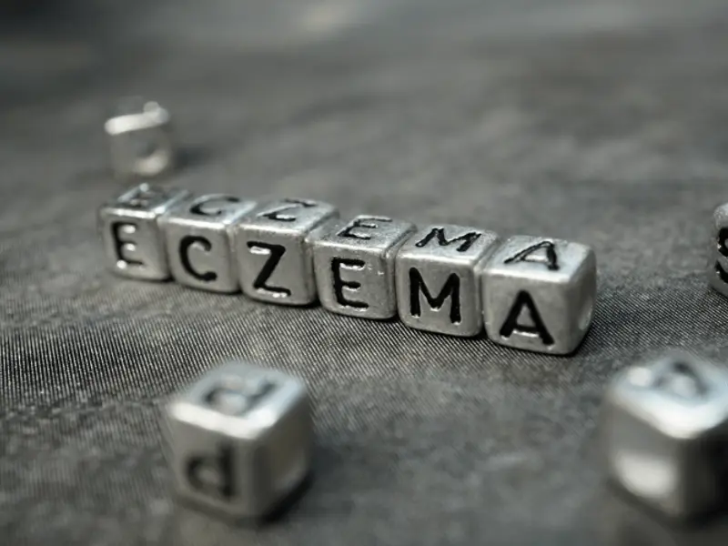 Why eczema, why now?