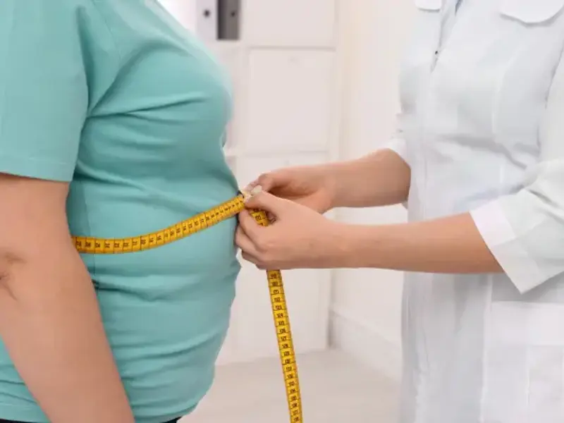 Obesity/overweight in adults - clinical fact sheet and MCQ